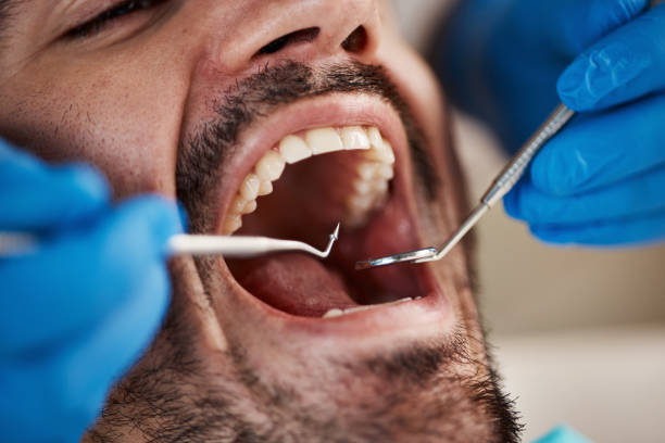 Best Urgent Tooth Repair  in Duryea, PA